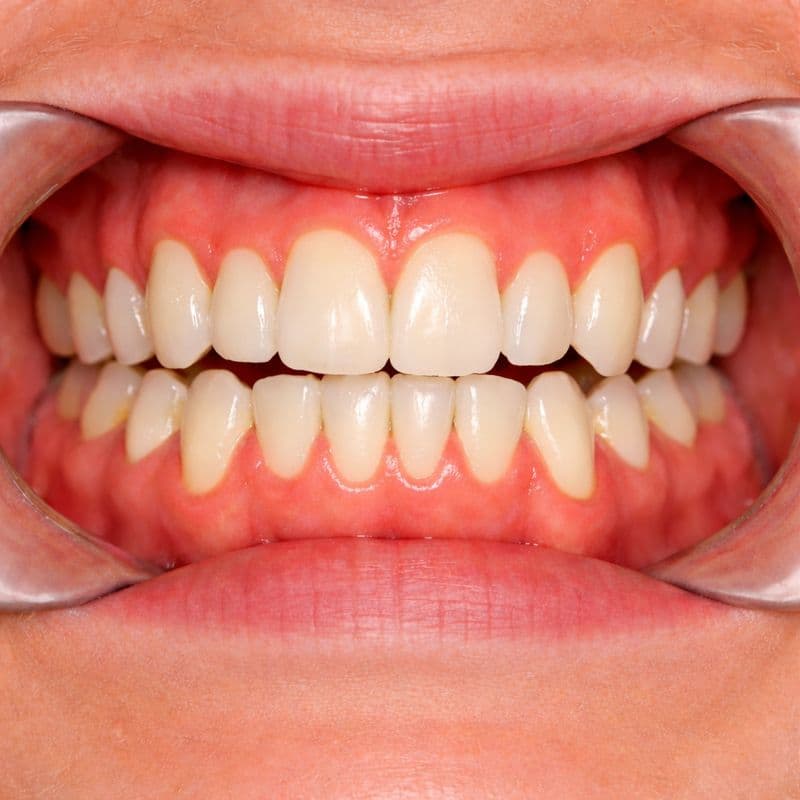 After Dec 15, 2024, 8:12:30 AM